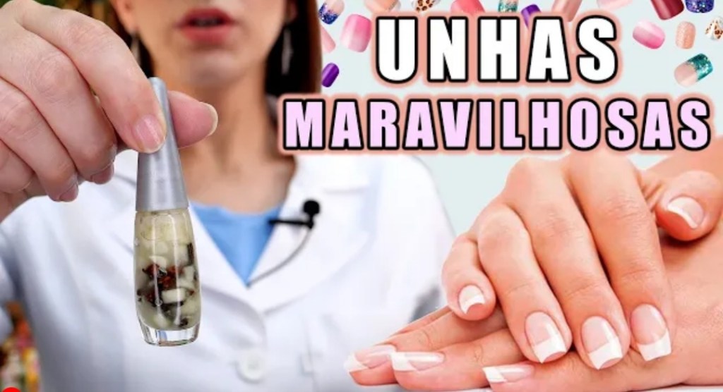 Assista a “Tenha UNHAS GRANDES e FORTES com essa Receita Caseira !” no YouTube